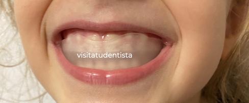 boca visitatudentista