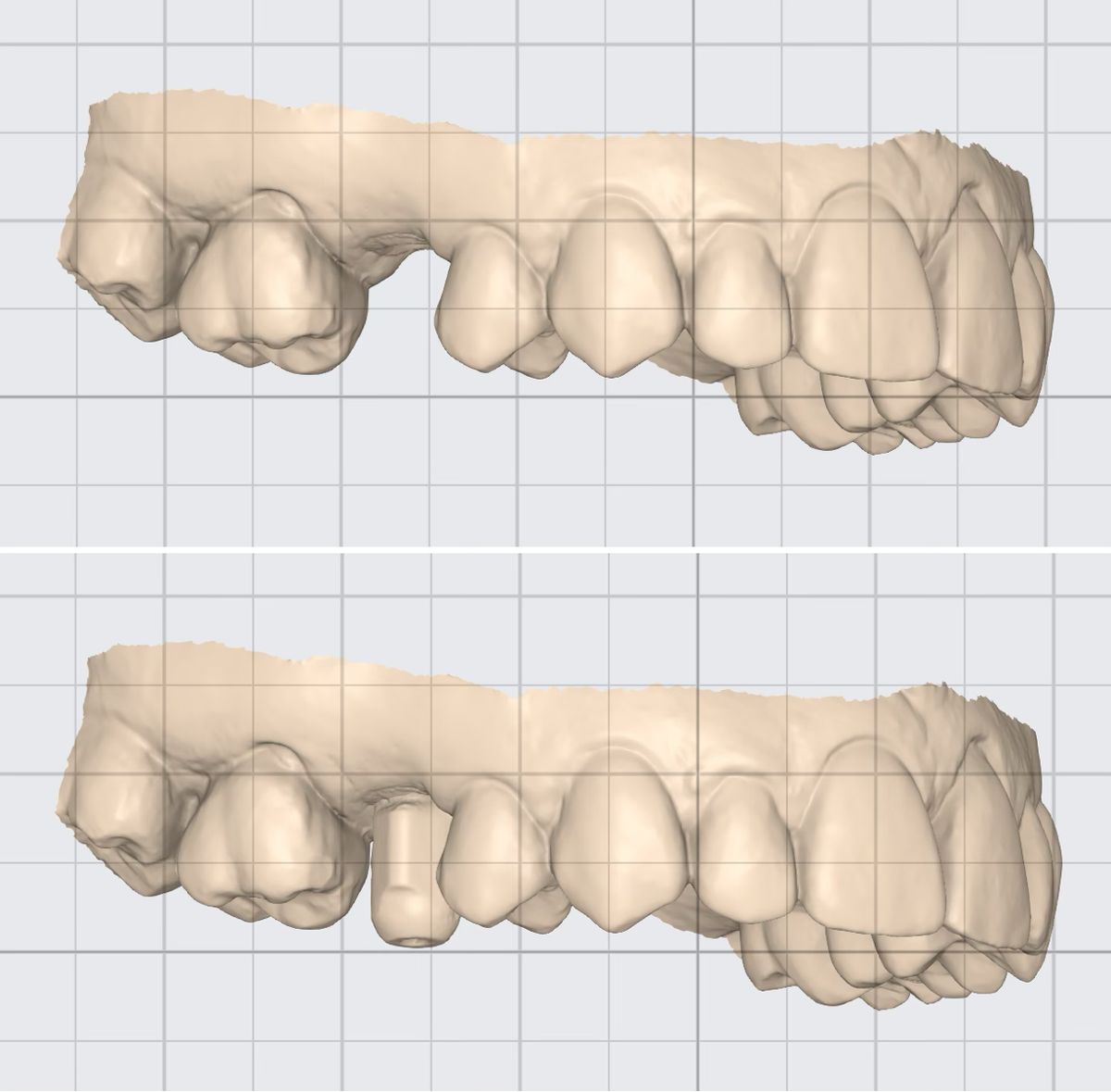 Imagen digital 3D