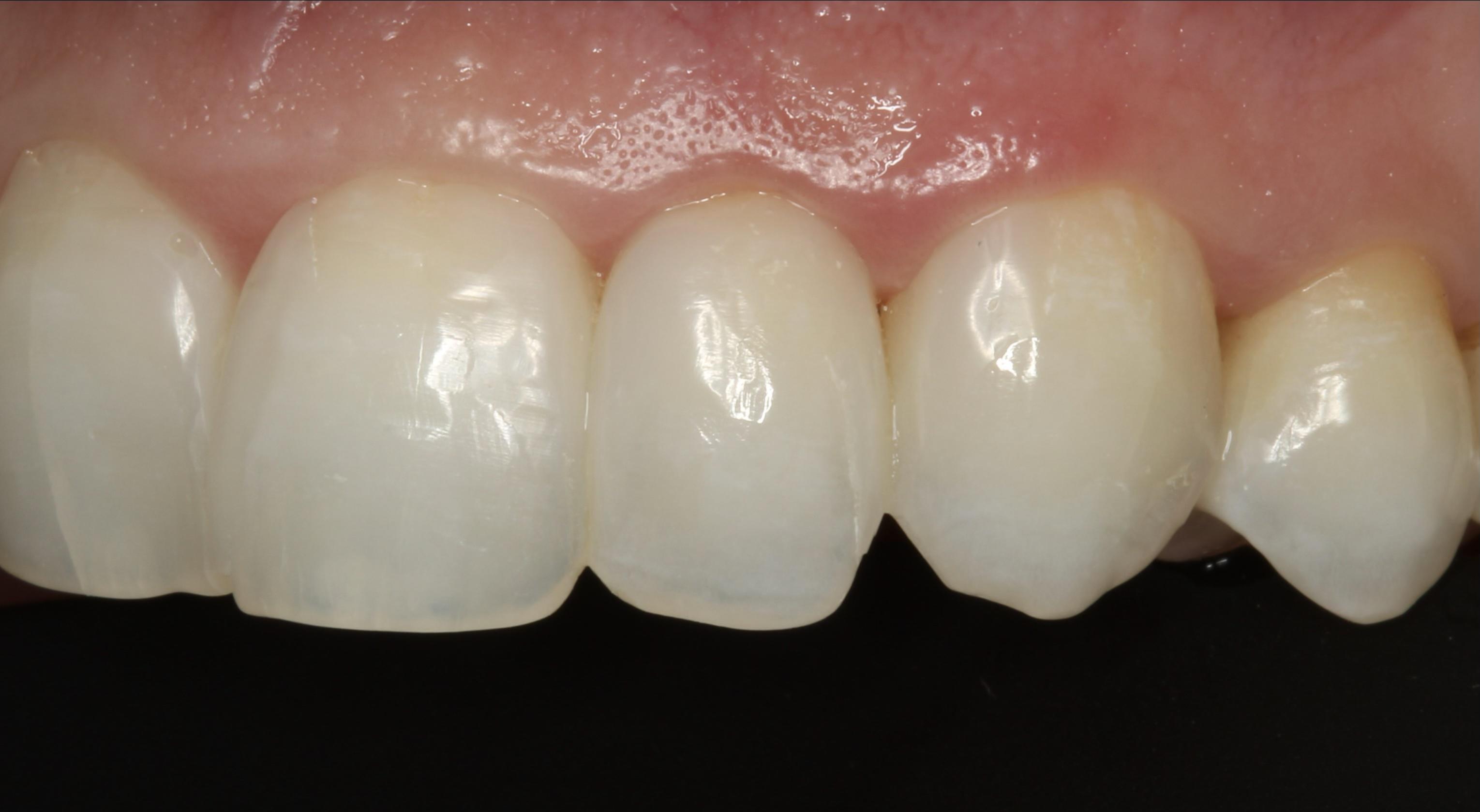 Estética dental